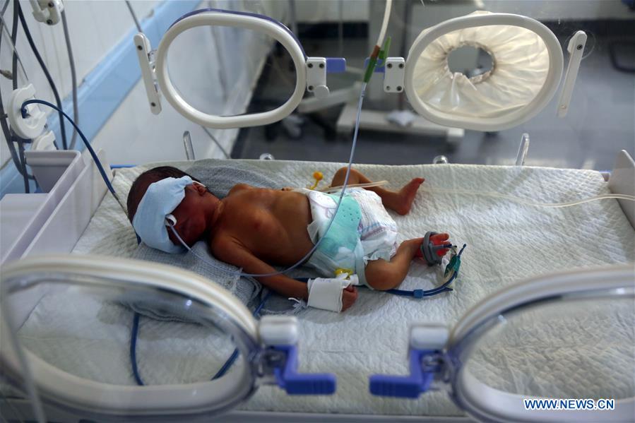 YEMEN-SANAA-WAR-TORN ZONE-BABIES